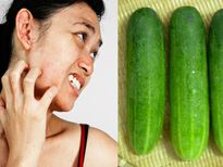 അറിയാതെ പോകരുത് കക്കിരിയുടെ ഈ ദോഷഫലങ്ങള്‍