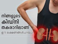 കിഡ്‌നി തകരാറ് ഗുരുതരമാകാം; ഈ ലക്ഷണം കരുതിയിരിക്കൂ