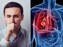 ക്ഷയരോഗ ചികിത്സയില്‍ ശ്രദ്ധിക്കണം ഈ ഭക്ഷണ ശീലം