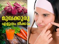 മുഖക്കുരു നീക്കാം; ഈ പച്ചക്കറികളിലുണ്ട് പരിഹാരം