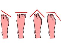 കാല്‍പ്പാദങ്ങളുടെ വിടവും നീളവും പറയും ചില രഹസ്യങ്ങള്‍