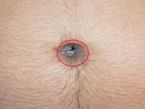 പൊക്കിളില്‍ ദിവസവും എണ്ണ പുരട്ടൂ, ഉറങ്ങുന്നതിന് മുന്‍പ്; ഫലം അതിശയകരം