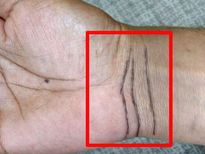 നിങ്ങളുടെ ആയുസ്സും ധനനഷ്ടവും നേട്ടവും മുന്‍കൂട്ടി പറയും ഈ വരകള്‍