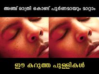 ചര്‍മ്മത്തിലെ കറുത്ത കുത്തുകള്‍ അഞ്ച് രാത്രിയില്‍ ഇല്ലാതാക്കാം