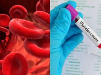 Thalassemia : പാരമ്പര്യമായി പകരുന്ന തലാസീമിയ; ലക്ഷണങ്ങളും ചികിത്സയും 