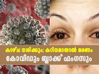 കാഴ്ചശക്തി നശിക്കും, കഠിനമായാല്‍ മരണവും; കോവിഡിനൊപ്പം ബ്ലാക്ക് ഫംഗസ്‌