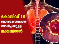 ശ്വാസകോശത്തിലെത്തിയാല്‍ കോവിഡ് കഠിനമാകും; ഈ ലക്ഷണങ്ങള്‍ കരുതിയിരിക്കൂ