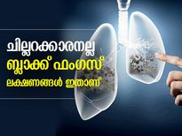 ബ്ലാക്ക് ഫംഗസ് എന്ന അപകടകാരി; ഈ ലക്ഷണങ്ങള്‍ പറയും അണുബാധ