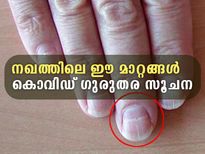 കൊവിഡ് ഉണ്ടോ, അതോ വന്നു പോയോ; നഖം പറയുന്ന ഗുരുതര ലക്ഷണം