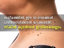  ഈ 10 ഭാഗങ്ങള്‍ മാസത്തിലൊരിക്കലെങ്കിലും പരിശോധിക്കണം; സ്‌കിന്‍ ക്യാന്‍സര്‍ ഭീഷണി