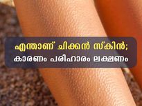 ചിക്കന്‍ സ്‌കിന്‍; ചര്‍മ്മത്തിലുണ്ടാവുന്ന ഈ അവസ്ഥ നിസ്സാരമല്ല