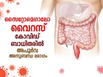 സൈറ്റോമെഗാലോ വൈറസ്; കോവിഡ് ബാധിതരില്‍ അപൂര്‍വ അനുബന്ധ രോഗം