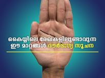 കൈയ്യിലുണ്ടാവുന്ന മോശം രേഖകള്‍ ഇതാണ്; ഭാഗ്യദോഷം ഫലം നല്‍കും