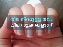  നഖത്തിലെ നീല നിറത്തിന് പിന്നില്‍ അപകടമുണ്ട്; ഗുരുതര അപകടം
