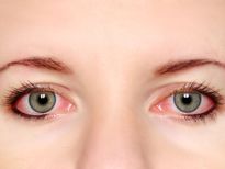Itchy Eyes Remedies: കണ്ണിന് ചൊറിച്ചിലുണ്ടോ ? എങ്കില്‍ സൂക്ഷിക്കണം