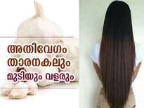 അതിവേഗം താരനകലും മുടിയും വളരും; മുടിക്ക് വെളുത്തുള്ളി പായ്ക്ക്‌