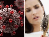 പോസ്റ്റ് കോവിഡ് ലക്ഷണങ്ങളില്‍ മുടികൊഴിച്ചിലും; ശ്രദ്ധിക്കേണ്ടത് ഇതാണ്