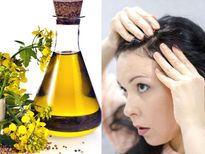 മുടിക്ക് ഈ എണ്ണയെങ്കില്‍ താരനും മുടികൊഴിച്ചിലും അടുക്കില്ല