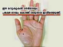 കൈയ്യിലെ ഈ മറുകുകള്‍ ശുഭസൂചകമോ അശുഭമോ മറുകിന്റെ സ്ഥാനം പറയും