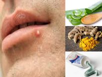 ചുണ്ടിലും വരും കുരു; ഇവ ചെയ്താല്‍ ഉടന്‍ പരിഹാരം