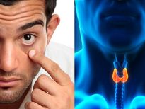 Thyroid Eye Disease: തൈറോയ്ഡ് തകരാറിലായാല്‍ കണ്ണിനും കാലക്കേട്; അവസ്ഥ ഗുരുതരം