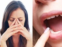 ഹോര്‍മോണ്‍ മാറിയാല്‍ പല്ലിനും പ്രശ്‌നം; സ്ത്രീകള്‍ ശ്രദ്ധിക്കേണ്ടത് ഇത്