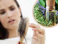 മുടികൊഴിച്ചിലകറ്റും മുടിക്ക് ഉള്ള് വളര്‍ത്തും ഈ എണ്ണ