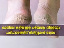 കാലില്‍ കട്ടിയുള്ള ചര്‍മ്മം ഇനിയില്ല: അഞ്ച് മിനിറ്റില്‍ പരിഹാരമിതാ