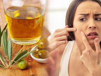 പാടുകളും മുഖക്കുരുവും നീക്കി മുഖസൗന്ദര്യം കൂട്ടാന്‍ ഈ എണ്ണ