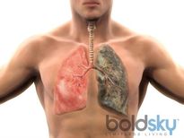 പുകവലിക്കുന്നവരാണോ നിങ്ങള്‍? നിര്‍ബന്ധമായും ചെയ്യണം ഈ മെഡിക്കല്‍ പരിശോധനകള്‍