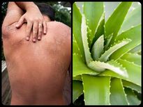 സൂര്യാഘാതം നിസ്സാരമല്ല: അപകടഘട്ടം ഇതാണ്-പരിഹാരവും