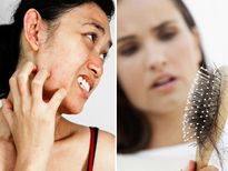 പ്രതിരോധശേഷി കുറവ്; ശരീരം കാണിക്കും ലക്ഷണങ്ങള്‍ ഇവ