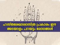  കൈകളിലെ ഈ അടയാളങ്ങള്‍ നിങ്ങളുടെ രോഗത്തെ മുന്‍കൂട്ടി പറയും