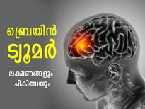 ലോക ബ്രെയിന്‍ ട്യൂമര്‍ ദിനം; മാരകരോഗം തിരിച്ചറിയാം ഈ ലക്ഷണങ്ങളിലൂടെ
