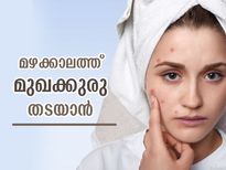 മഴക്കാലത്ത് മുഖക്കുരു വഷളാകും; തടയാനുള്ള എളുപ്പ പരിഹാരം ഇത്