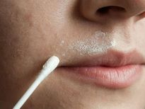 മുഖത്തെ നരച്ച രോമങ്ങള്‍ ഇനി ഈസിയായി മാറ്റാം