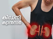 പുരുഷന്‍മാരെ അധികമായി പിടികൂടും കിഡ്‌നി ക്യാന്‍സര്‍; ഈ ലക്ഷണങ്ങളെ കരുതിയിരിക്കൂ
