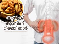 യൂറിക് ആസിഡ് കുറയ്ക്കാന്‍ സഹായിക്കും ഈ ഡ്രൈ ഫ്രൂട്ടുകള്‍