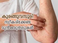 കുരങ്ങുവസൂരി ആഗോള പകര്‍ച്ചവ്യാധി; രോഗത്തില്‍ നിന്ന് രക്ഷനേടാന്‍ വേണ്ട മുന്‍കരുതലുകള്‍