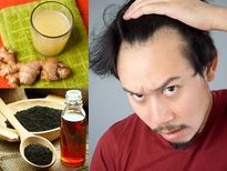 തലയില്‍ കഷണ്ടി പാടുകളുണ്ടോ? അവിടെയും മുടി കിളിര്‍പ്പിക്കും ഈ വീട്ടുവൈദ്യങ്ങള്‍