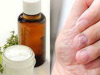 ചര്‍മ്മപ്രശ്‌നങ്ങള്‍ക്ക് പരിഹാരം കാണണോ? കര്‍പ്പൂര തൈലം ഈ വിധം പുരട്ടൂ