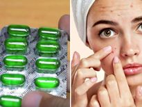 വിറ്റാമിന്‍ ഇ ക്യാപ്‌സൂള്‍ ഈ വിധം പുരട്ടിയാല്‍ തിളങ്ങുന്ന മുഖം സ്വന്തം