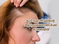 മുടികൊഴിച്ചിലും താരനുമൊക്കെയാണോ പ്രശ്‌നം? ഈ കാരണങ്ങള്‍ അറിഞ്ഞ് വേണം ചികിത്സ