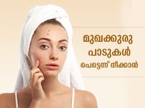 മുഖക്കുരു മാറിയാലും പാടുകള്‍ പോകണമെന്നില്ല; അതിനുള്ള പരിഹാരം ഇതാണ്