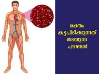 ധമനികളില്‍ രക്തം കട്ടപിടിക്കുന്നതിലെ അപകടം ഗുരുതരം: പരിഹാരം ഈ പഴങ്ങള്‍