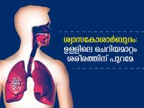ശ്വാസകോശാര്‍ബുദം: മറ്റ് ഭാഗങ്ങളിലേക്ക് പടര്‍ന്നാല്‍ ശരീരം കാണിക്കും ലക്ഷണം