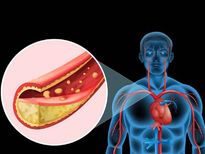 ഈ ശീലങ്ങളിലൂടെ ശരീരത്തിലെത്തിക്കാം നല്ല കൊളസ്‌ട്രോള്‍; ഒപ്പം ആരോഗ്യവും