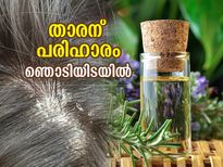 താരന്‍ പ്രശ്‌നം ഇനി നിങ്ങളെ അലട്ടില്ല; ഈ ഹെര്‍ബല്‍ ലോഷനിലുണ്ട് പ്രതിവിധി