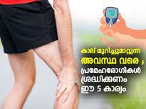 പ്രമേഹം നിങ്ങളുടെ കാലുകള്‍ക്കും പ്രശ്‌നം; അസഹനീയമായ വേദന തടയാന്‍ ഈ 5 കാര്യം ശ്രദ്ധിക്കണം