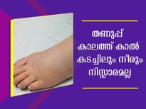 കാല് കടച്ചിലും വേദനയും എല്ലാം മാറ്റാം വീട്ടില്‍ തന്നെ